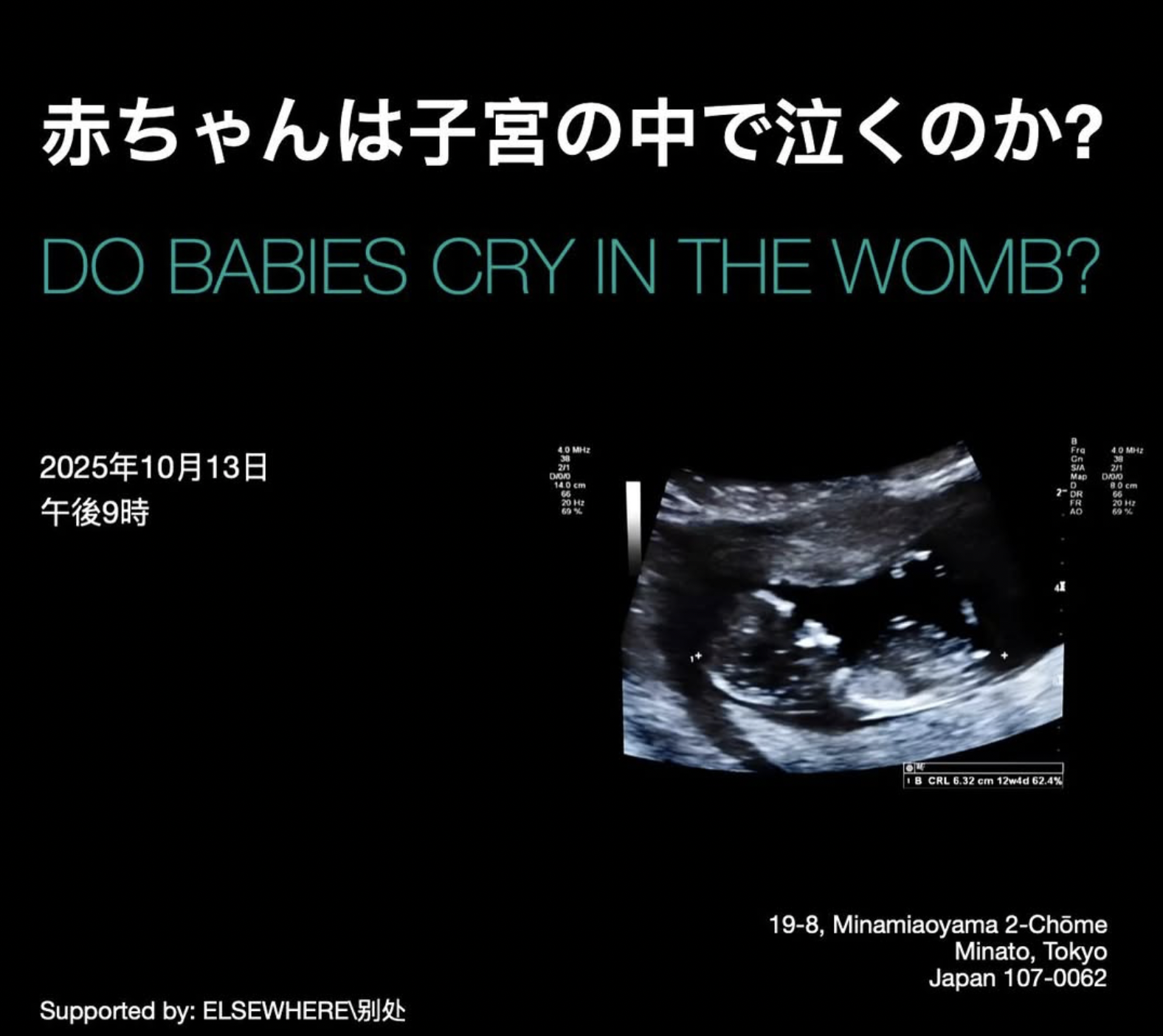 Economic possibilities for our grandchildren